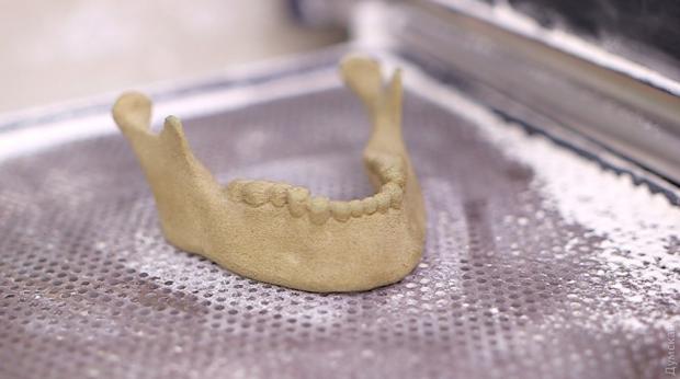 В Украине начали печать имплантов костей на  3D-принтере
